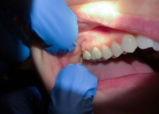 Best Same-Day Emergency Dentist in Walce Ridge, LA